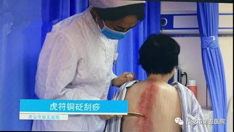 西安市第五医院中医特色诊疗技术获广泛赞誉