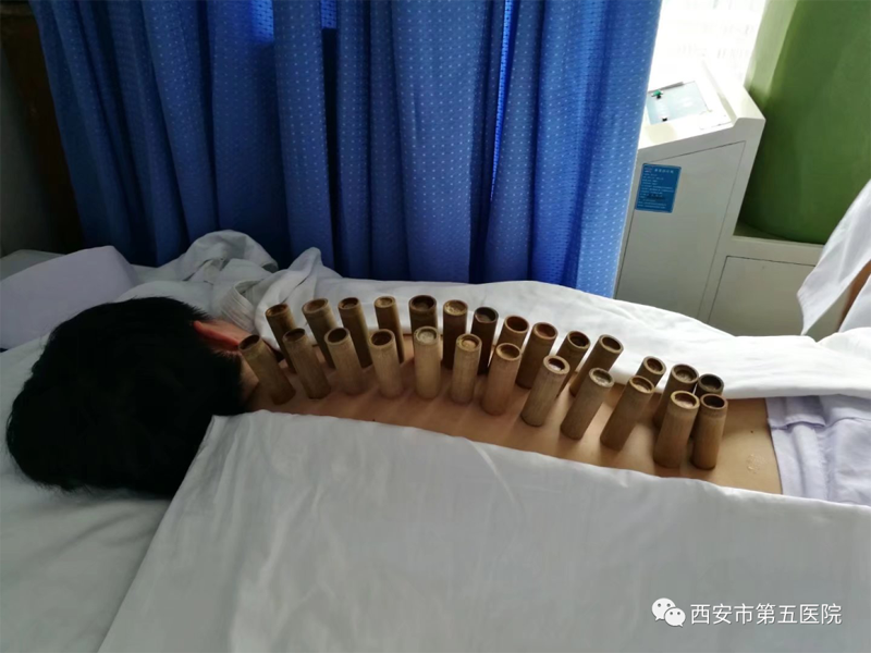 西安市第五医院中医特色诊疗技术获广泛赞誉