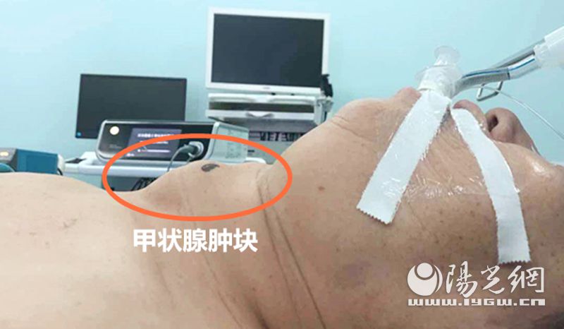 西安大兴医院为患者摘除长了29的甲状腺肿瘤